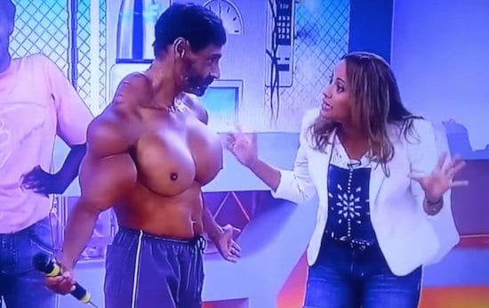Most Outrageous Synthol Freaks In The World