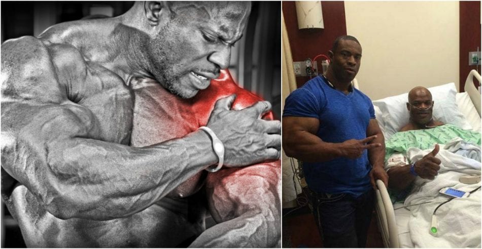 shoulder mistakes