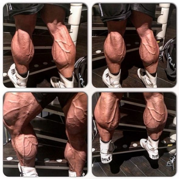 calves