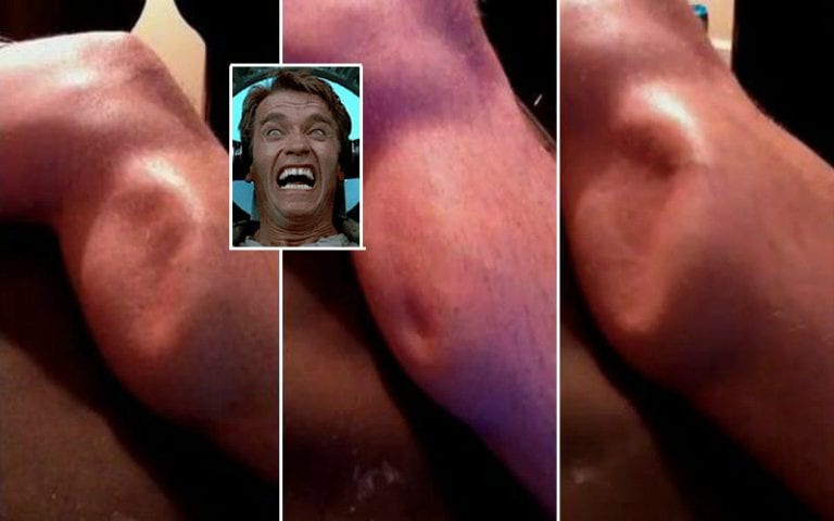 muscle cramps are insane