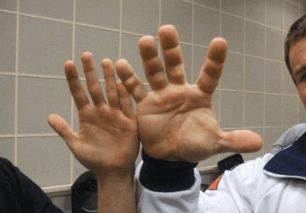 denis cyplenkov hands