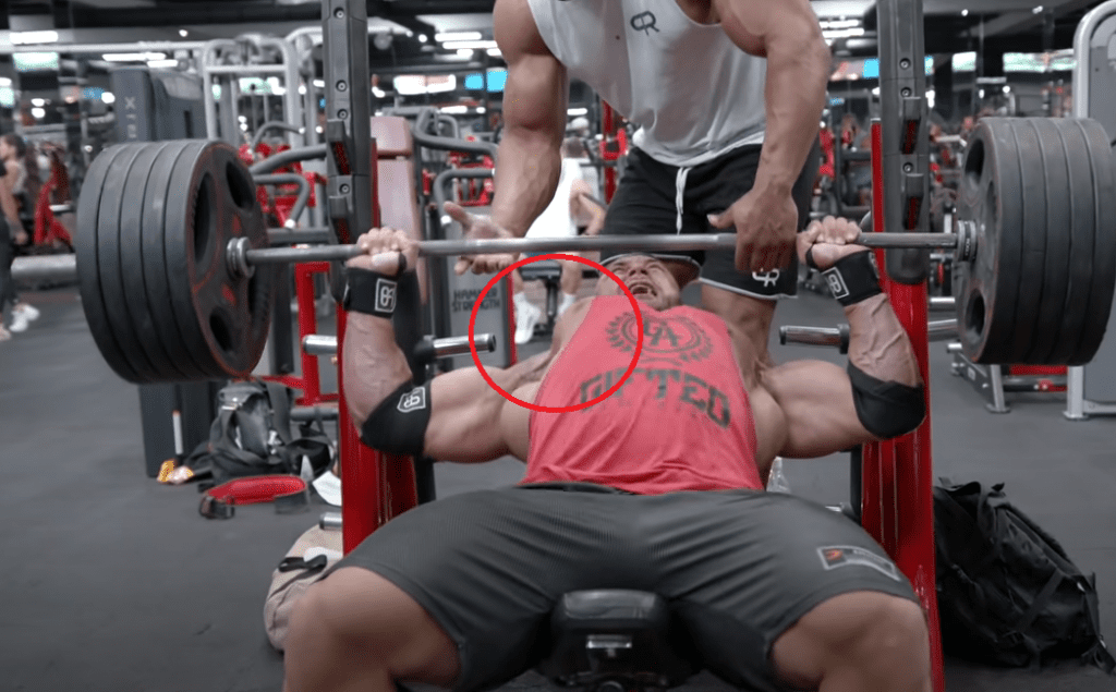 ryan crowley pec tear