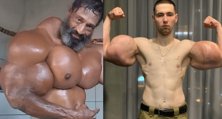 synthol freaks