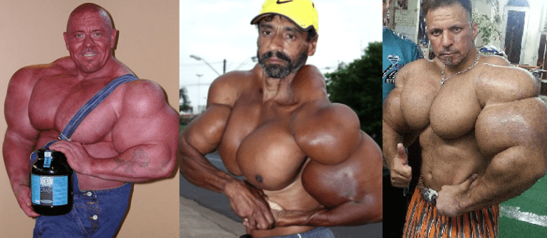 biggest synthol bodybuilders
