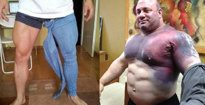 bodybuilder downsides