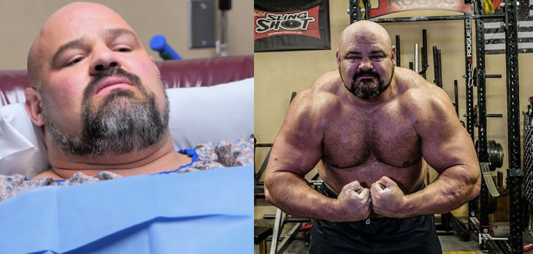 brian shaw leg infection