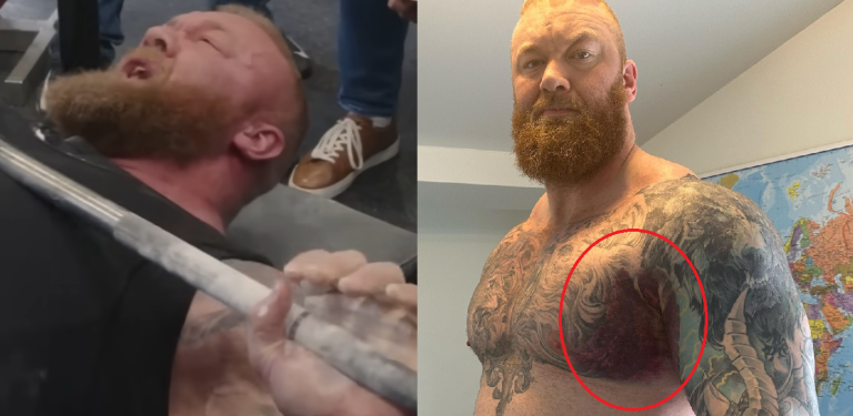hafthor pec tear